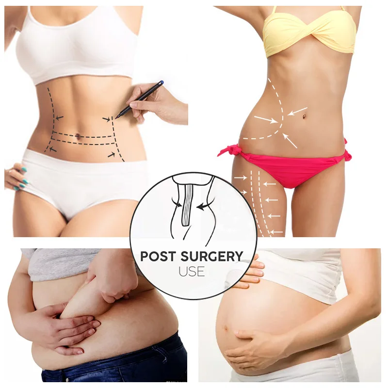 Miss Moly Postpartum Invisible Belly Control Bandage Fajas Postparto Slimming Intimates Female Recovery Post Partum Girdle