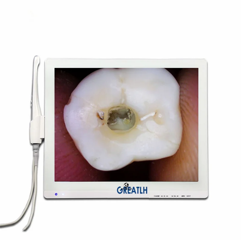 

Зубная интраоральная камера с монитором с светодиодный, зубная камера для полости рта с 17-дюймовым монитором, HD интраоральная камера