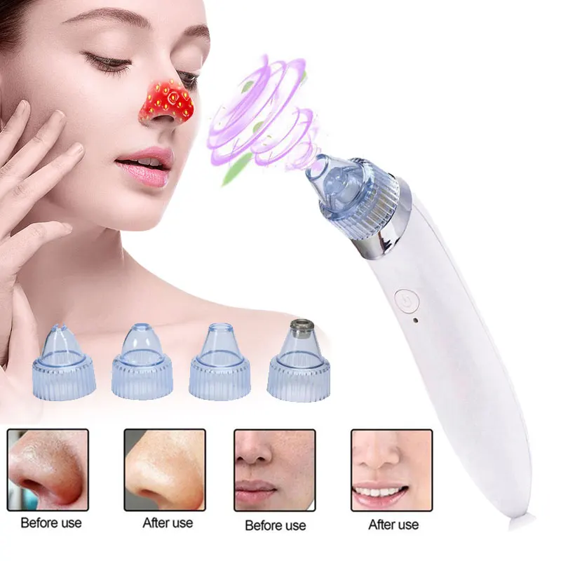 

Electric Vacuum Pore Cleaner Pro Blackhead Vacuum Suction Acne Clean Exfoliating Cleansing Comedo Suction Pore Cleaner