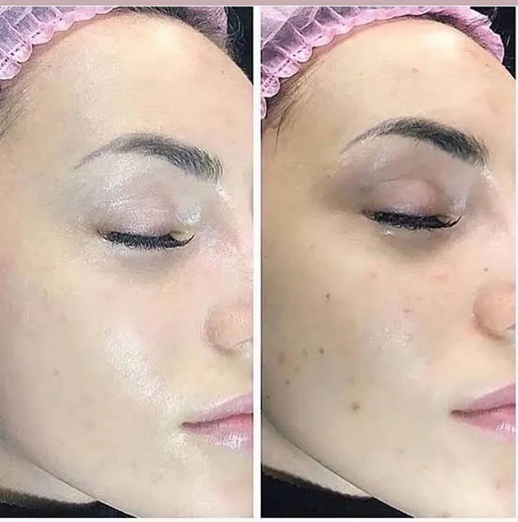 

12pcs/box stayve BB CREAM GLOW ampoule tarter kit mix shades brightening foundation bb meso glow MTS Dermawhite treatment