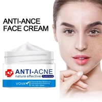 effective anti acne face cream acne treatment fade spots firming skin pores whitening care cream shrink acne acne moisturiz j9y5