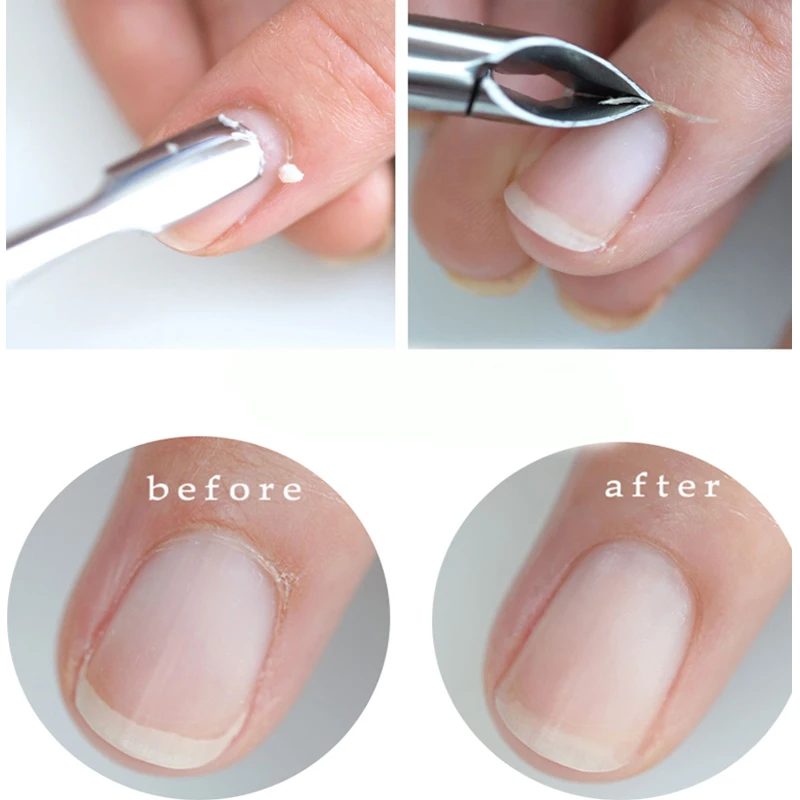Новинка 2 шт./компл. средство для удаления кутикулы УФ-гель ногтей набор грунтовка