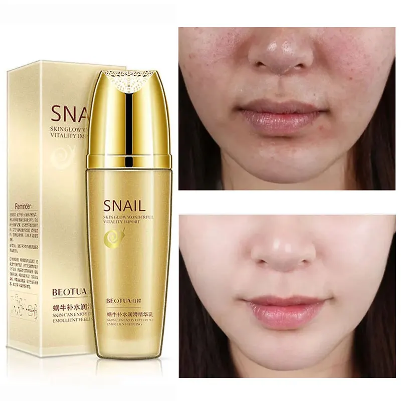 

Snail Serum Lotion Moisturizing Oil Control Whitening Anti-Wrinkle Anti-Aging Nourish Allantoin Hyaluronic Acid Skin Care 100ml