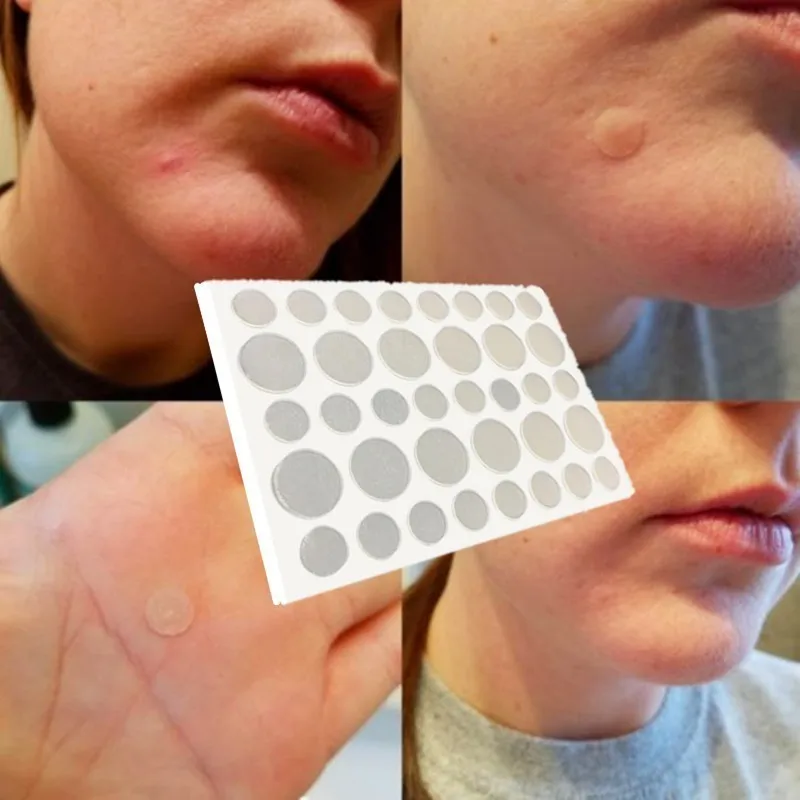 36 шт. пластырь для лечения акне|Устройство ухода за кожей лица| |