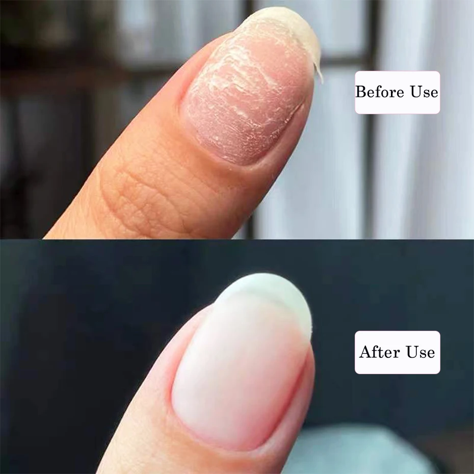 5ml Instant Nail Repair Gel for Cracked Broken Nails Strong Extension Silk Fiberglass Glue Clear Semi Permanent Varnish GL1520-1 images - 5