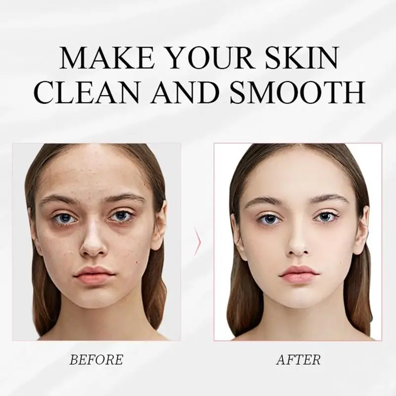 

1pcs Deep Cleansing, Shrinking Pores, Moisturizing, Whitening And Blossom Oil-controlling, Mask Acne-removing Mud K6K6