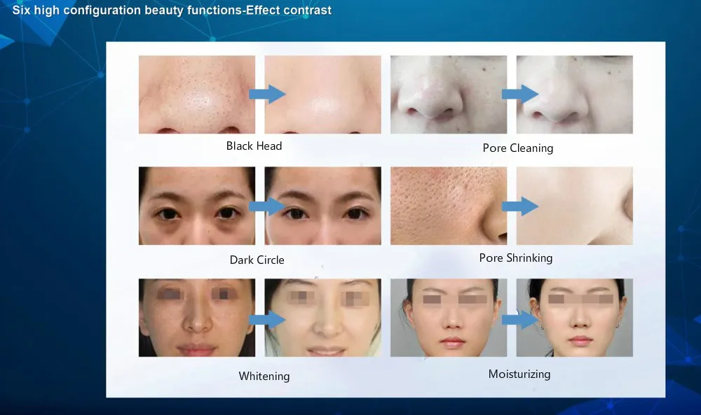 

Smart Ice Blue Hydra Therapy Facial Beauty Equipment With Skin Analyzer 7 in 1 Skin Management Machine