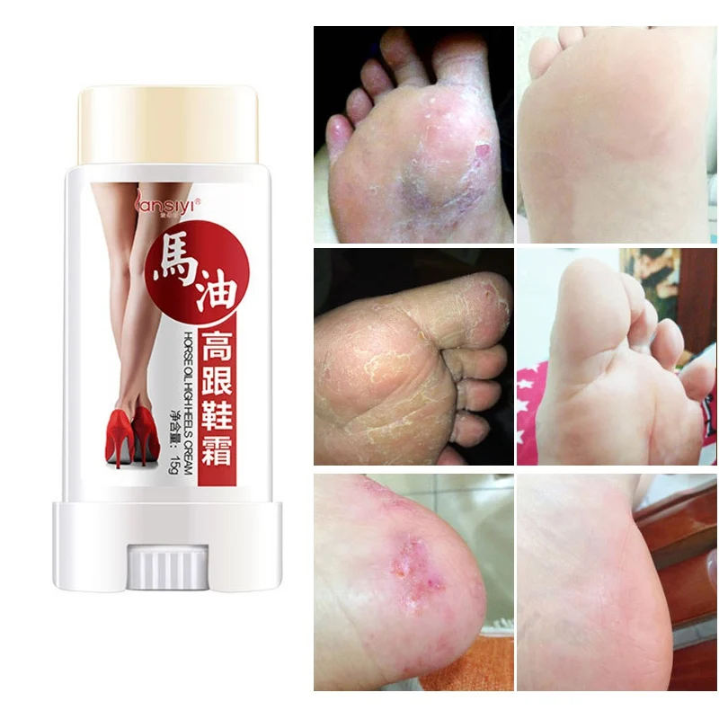 Крем для ног предохраняет от натирания пятен и | Красота здоровье