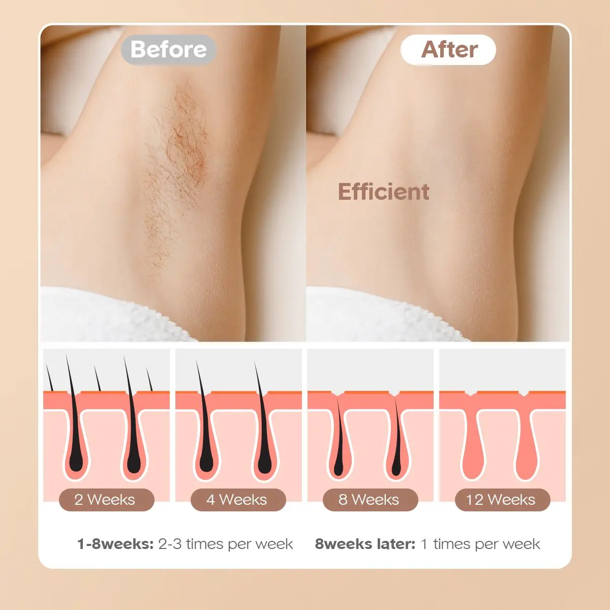 Эпилятор для удаления волос Innza IPL устройство лазерный Перманентный 2 режима 5