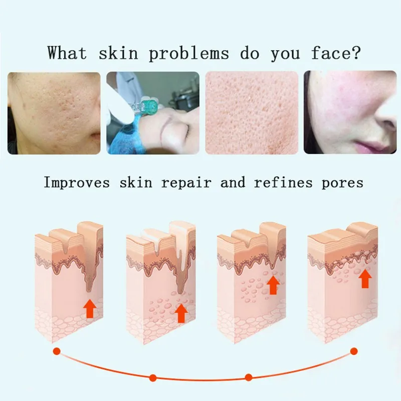 Очищающая поры эссенция увлажняющая Успокаивающая невидимая Сыворотка для пор