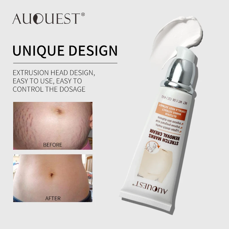 

AUQUEST 45g Remove Pregnancy Scars Acne Cream Stretch Mark Treatment Maternity Repair Anti-Aging Anti-Winkle Firming Body Cream