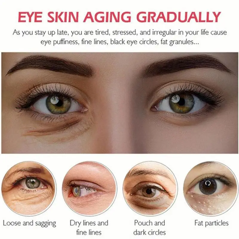 

Firming Eye Cream 30G Tight Moisturizer To Remove Edema Fine Eliminate Fat Eye Particles Lines Eliminate and Black Q2T5