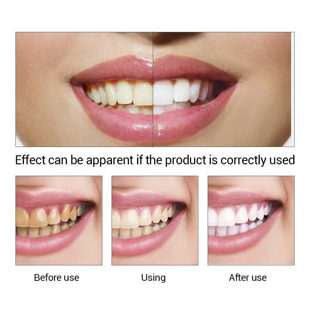 

Teeth Whitening Essence Swabs Teeth Brightening Bleaching Serum Remove Plaque Stain Oral Cleanser clareador blanqueador dental