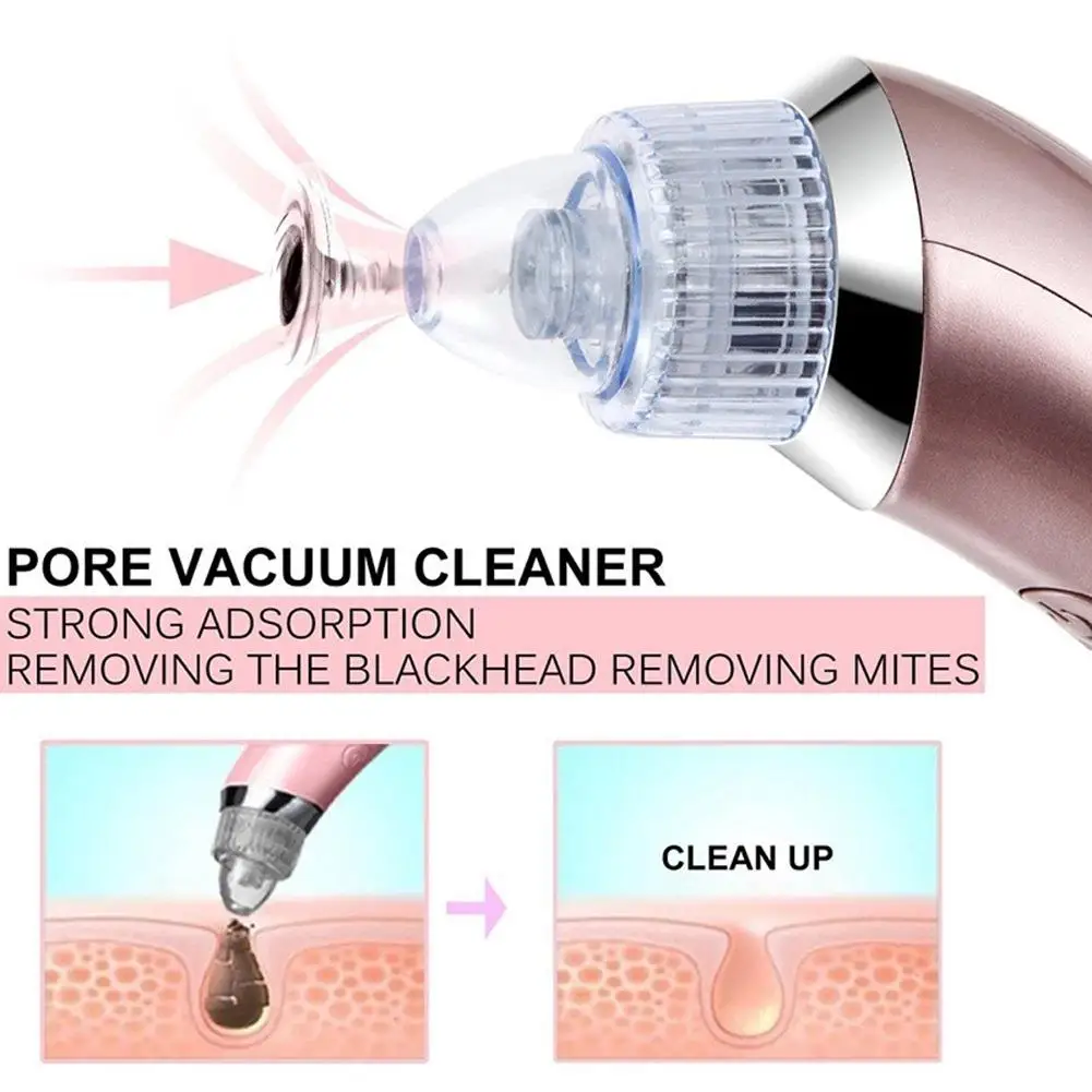 

Beauty Blackhead Remover Face Deep Pore Ultrasonic Acne Skin Scrubber Cleaning Pore Peeling Blackhead Removal Skin Care Tool