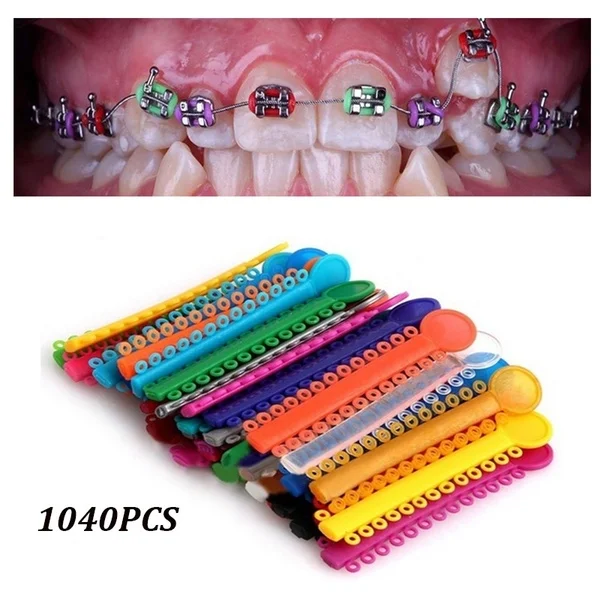 

1 Roll(40g) Dental Orthodontic Stainless Steel Ligature Wires 0.2mm/0.25mm/0.3mm For Orthodontic Treament & 1040pcs Ligature Tie