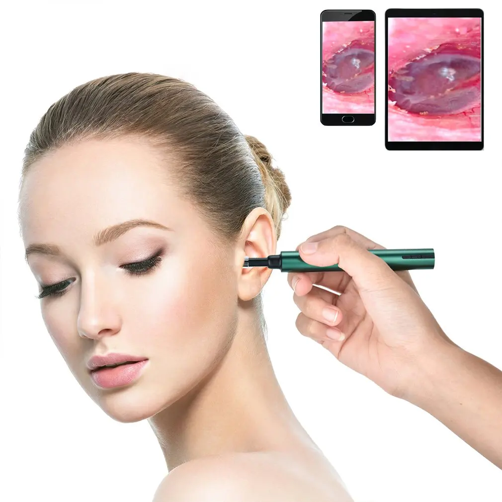 

Wireless WiFi Earpick Medical Otoscope Waterproof Camera Earwax Visual Oral Inspection Ear Spoon IOS Ear Cleaning Tool
