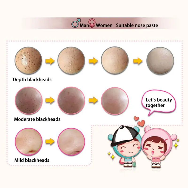 Маска для удаления черных точек на носу 3 шага|Средства ухода и маски| |