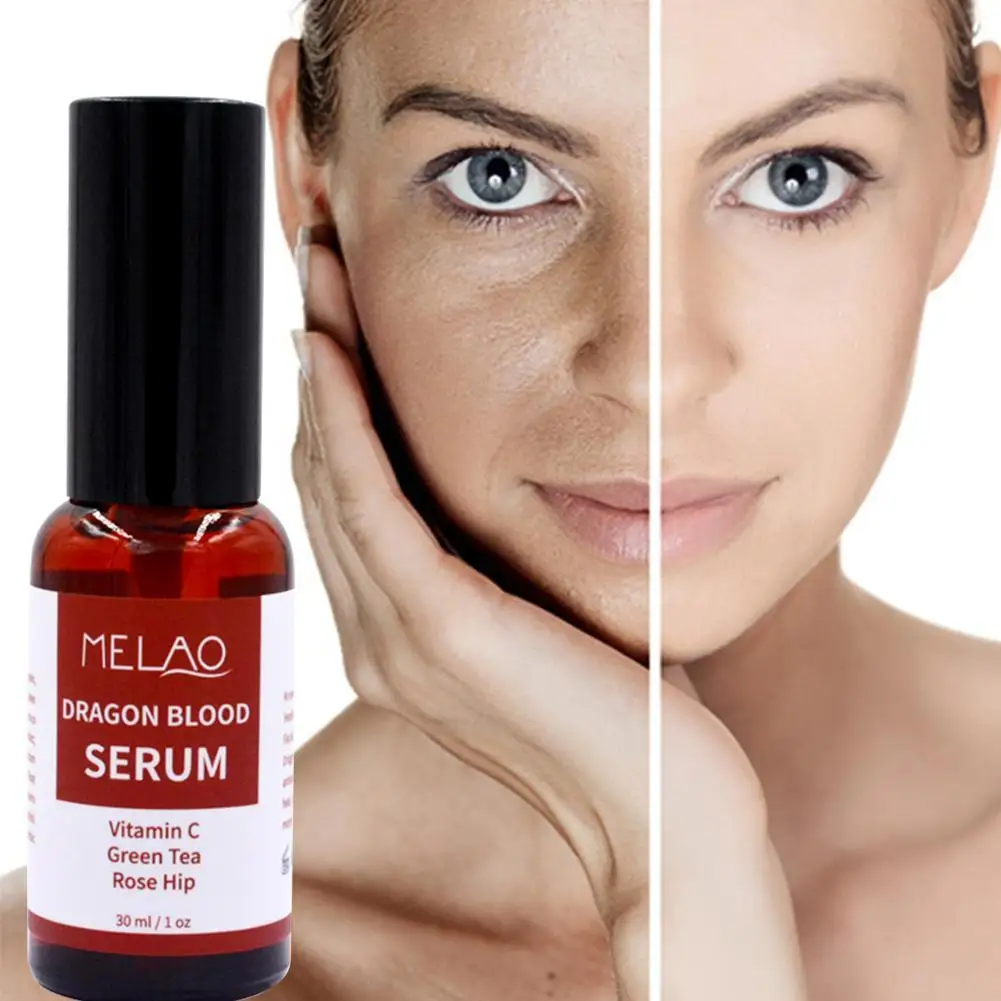 

30ml Whitening Face Serum Anti-acne Brightening Skin Essence Shrinking Pores Lifting Firming Moisturizing Care