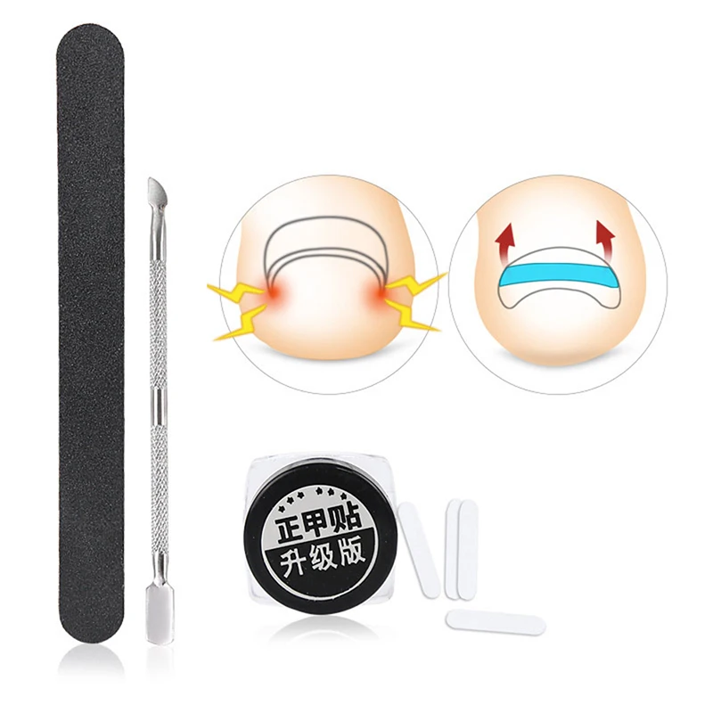 Инструмент из нержавеющей стали для ухода за вросшими ногами | Красота и здоровье