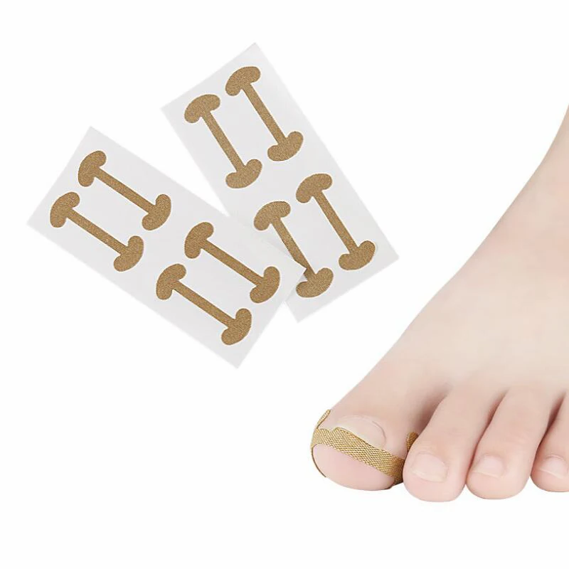 

Professional Embedded Toe Nail Corrector Sticker Toenail Care Pedicure Thumb Curl Correction Sticker