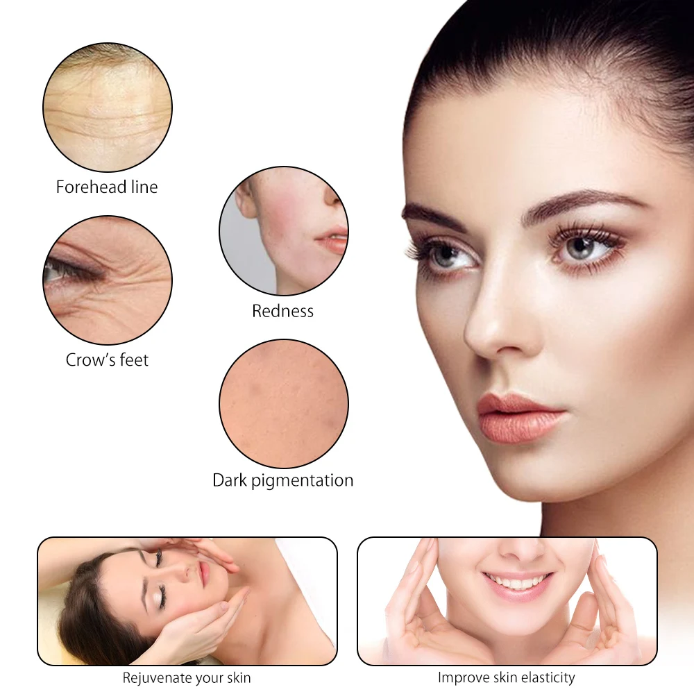 Дерма ручка для удаления морщин с микроиглами|Мезороллер| |