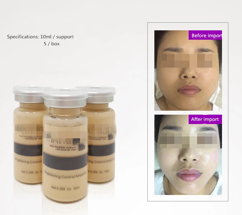 

Brightening control ampoule Foundation Liquid Essence Modify skin tone, moisturize, lift and tighten 5pcs/box 10ml*5