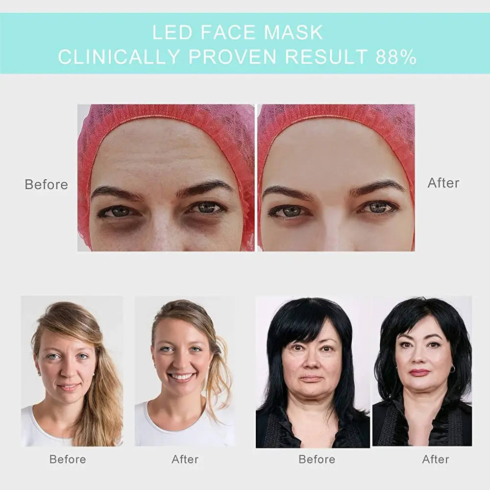 Светодиодная фототерапия Hydraskincare с красным и синим светом спа ФДТ для красоты