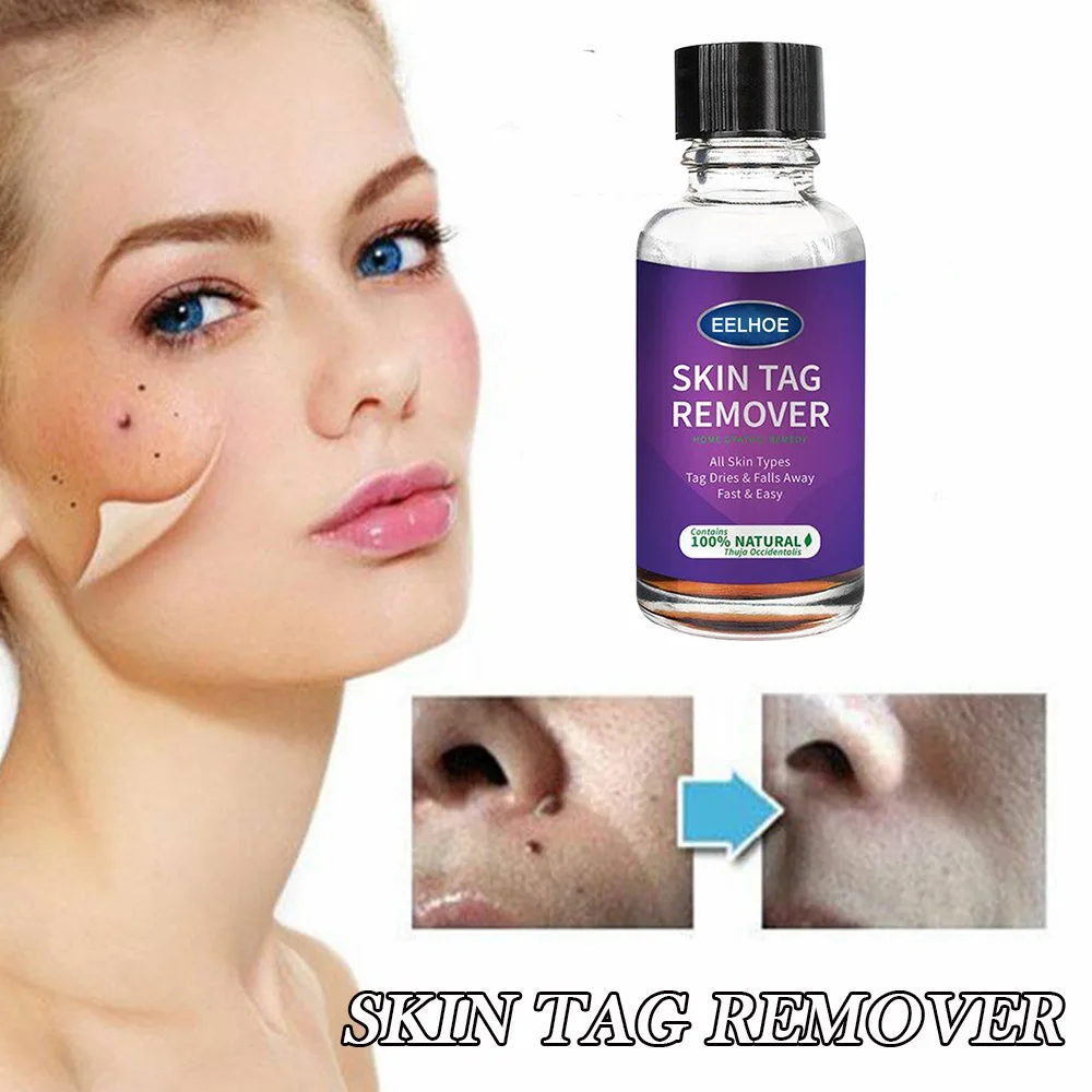 

Антибактериальная жидкость для удаления бородавок, 30 мл