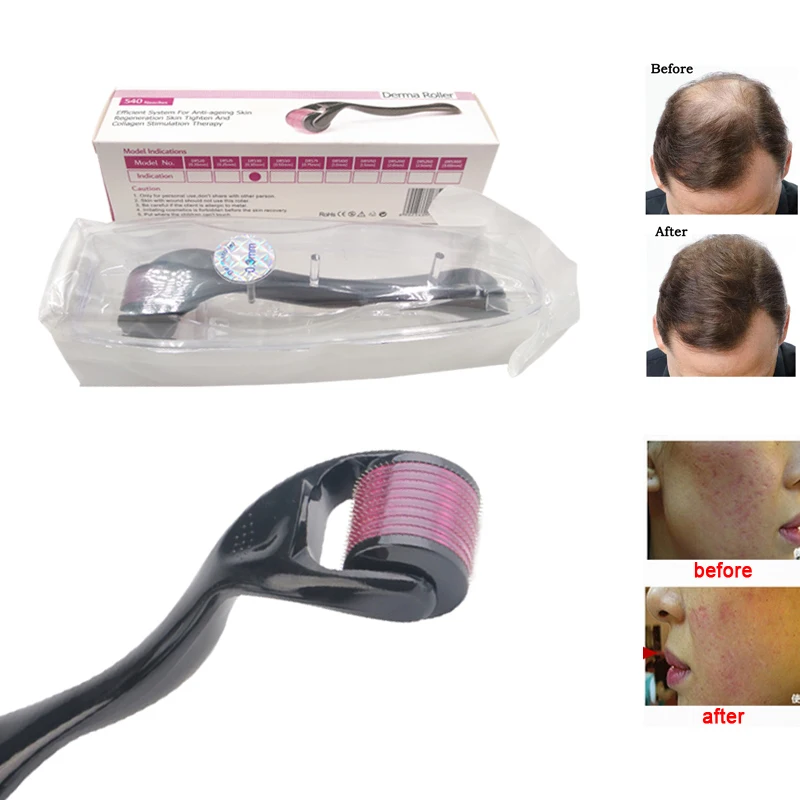 

10PCS Micro Needle Roller 540 Derma Roller Dermaroller Titanium Hair Regrowth Beard Growth Anti Hair Loss Thinning Hair Receding