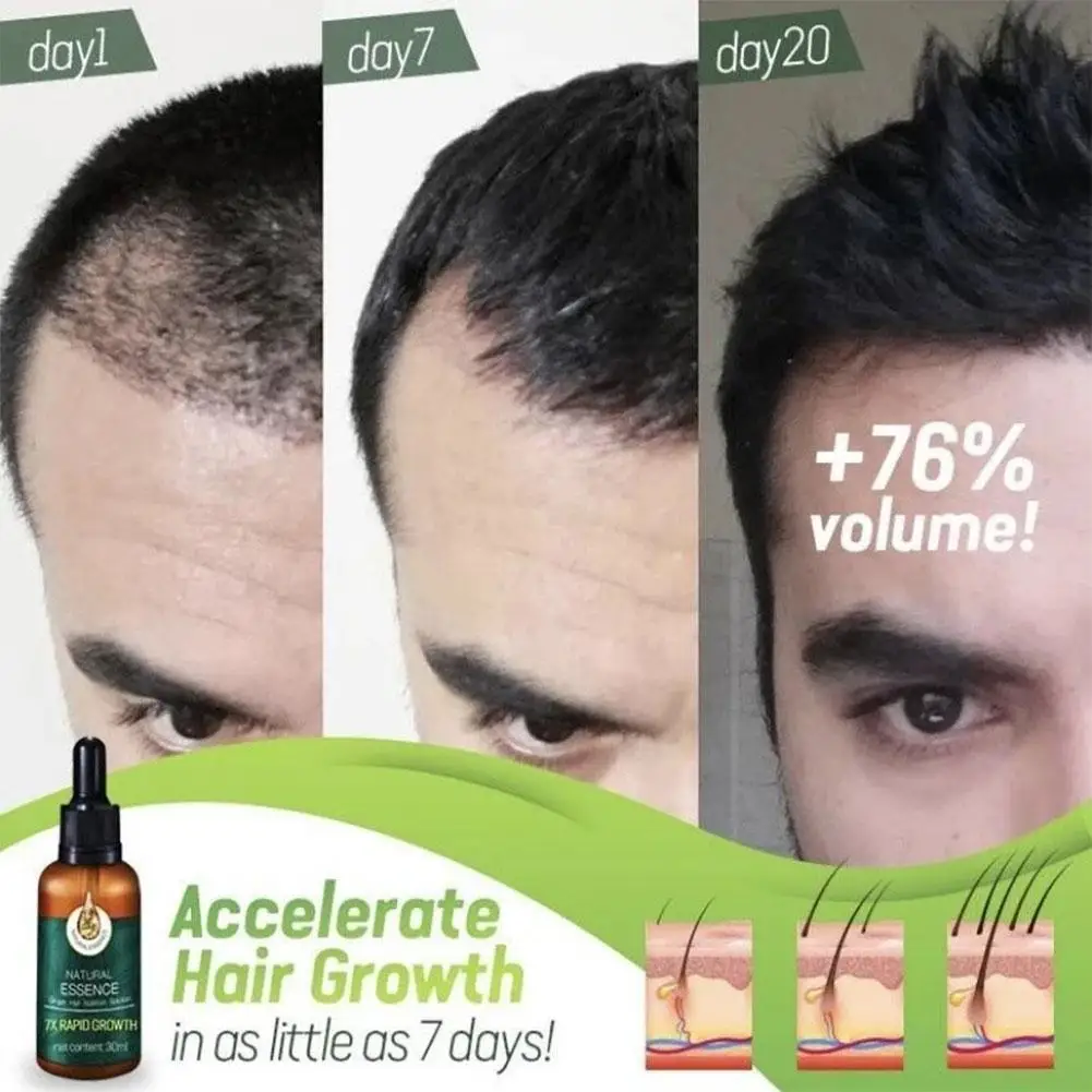 

Hair Glowth Serum Ginger Essence Germinal Hair Growth Serum Hair Growing Essence Loss Oil Repair Fast Hair Ginseng Treatmen O3Y9