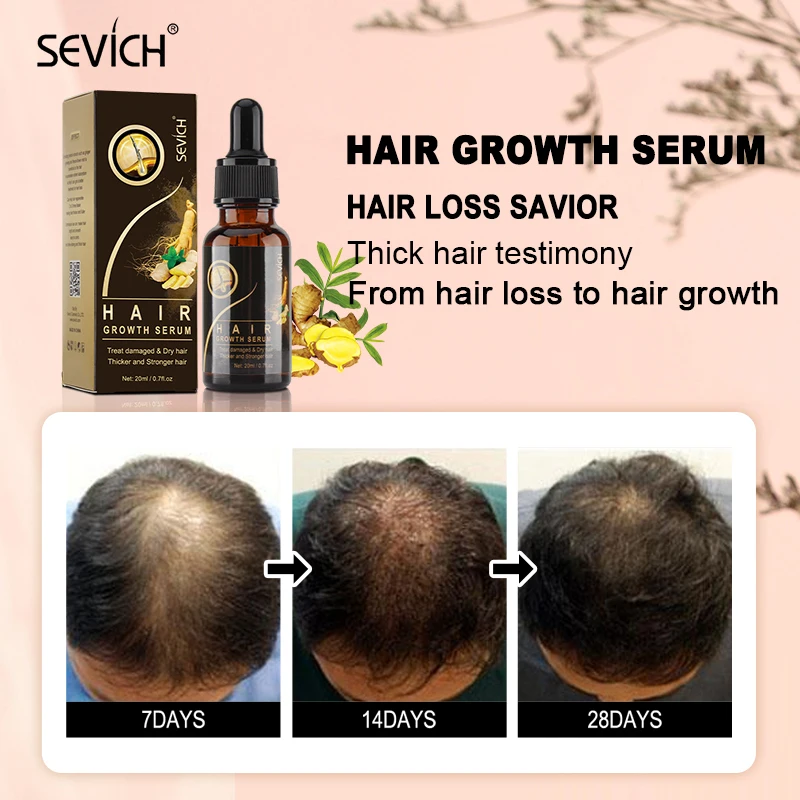 Продукты для роста волос Sevich имбирь эссенция эфирное масло сыворотка Уход за