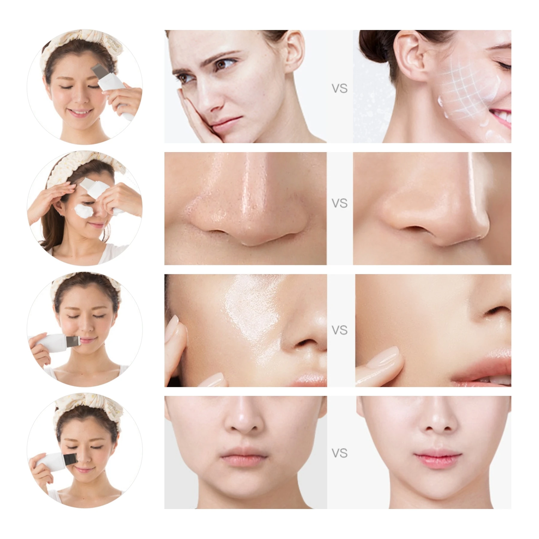 

Vibration brush deep cleaning, peeling tools, remove black spots, reduce wrinkles, ultrasonic shovel