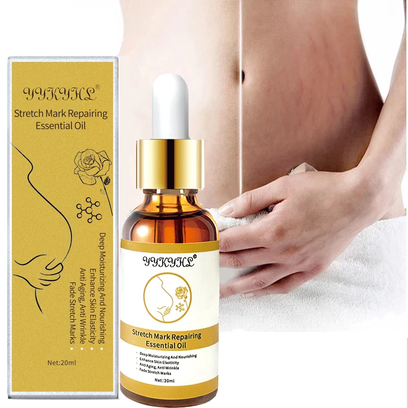 

Stretch Marks Remover Essential Oil Skin Care Treatment Cream For Stretch Mark Removal Maternity Slackline For Pregnant Oils