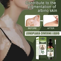 30ml vitiligo treament serum removal white spot melanin antibacterial psoriasis localized vitiligo mycosis leukoplakia skin care