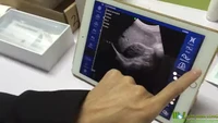 new released ultrasound transducer mslpu40 for abdomen testing wireless ultrasound scanner