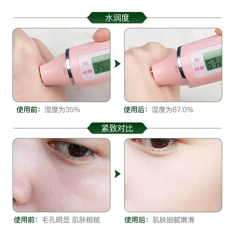 Лосьон для лица антивозрастной увлажняющий отбеливающий уход за лицом с