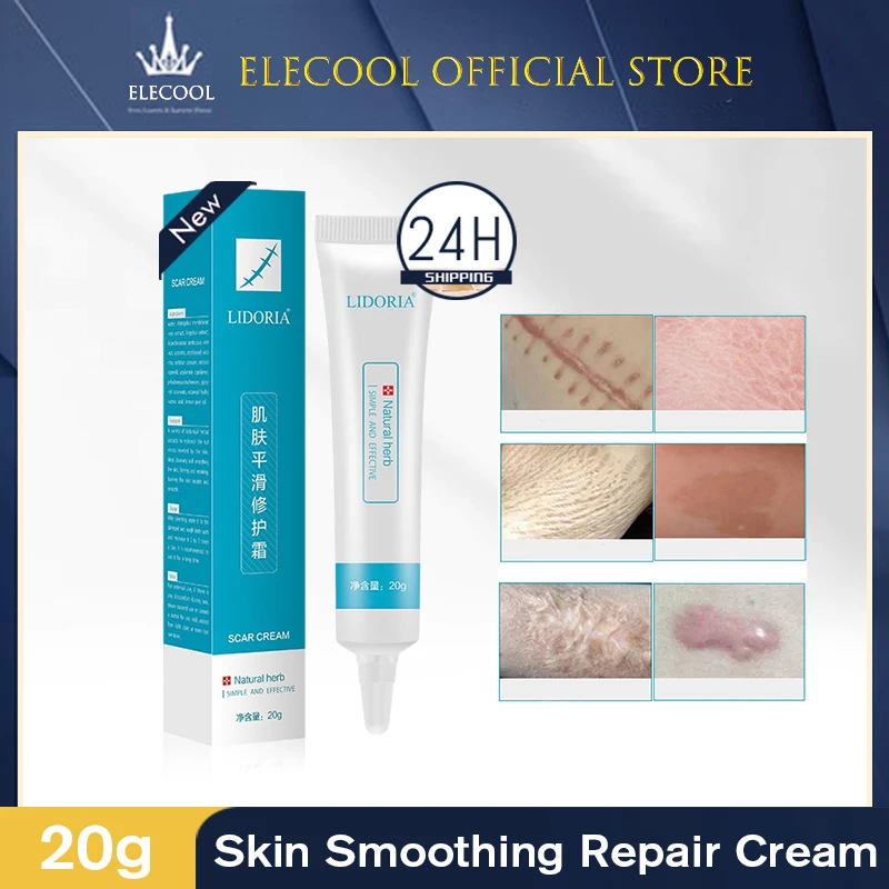 

LIDORIA Scar Removal Cream Acne Pimples Stretch Marks Remove Smooth Skin Body Blemish Treatments Repair Skin Care Regeneration