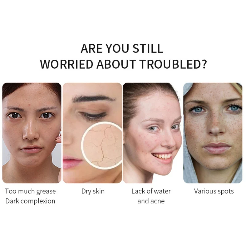 Дереза обыкновенная эфирные масла увлажняющее масло контроль укрепляющее уход