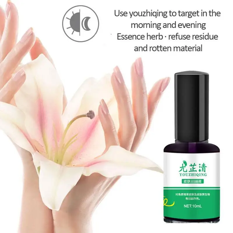 Nail Fungal Cure Nails Fungus Wart Removal Liquid Nutritious Anti Paronychia Onychomycosis Foot Repair 10ml | Красота и здоровье