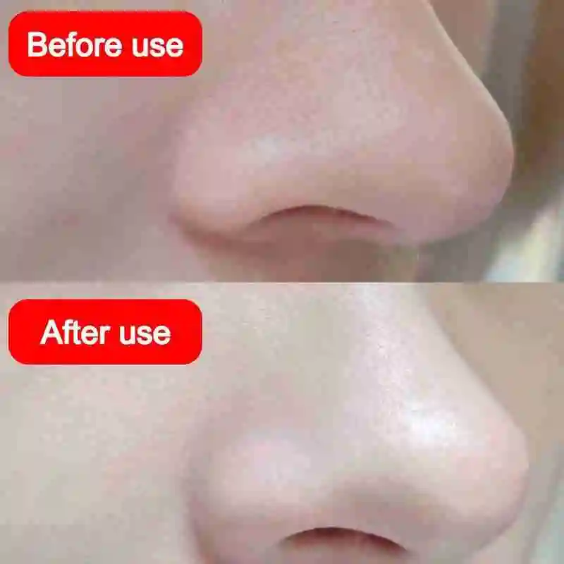 

Amino Acid Bubble Clay Mask Deep Pore Cleaning Shrink Pore Oil Mask Deep Cleansing Blackhead Control O8V9