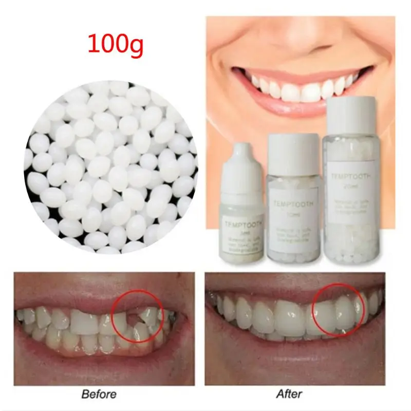 Рисунок 3 - Набор для временного ремонта зубных зазоров