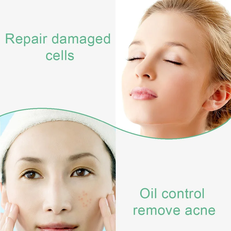 Aloe Vera Pure Liquid Essence Aloe Whitening Anti Wrinkle Serum Hyaluronic Acid Moisturizer Serum Face Care Acne Treatment TSLM1