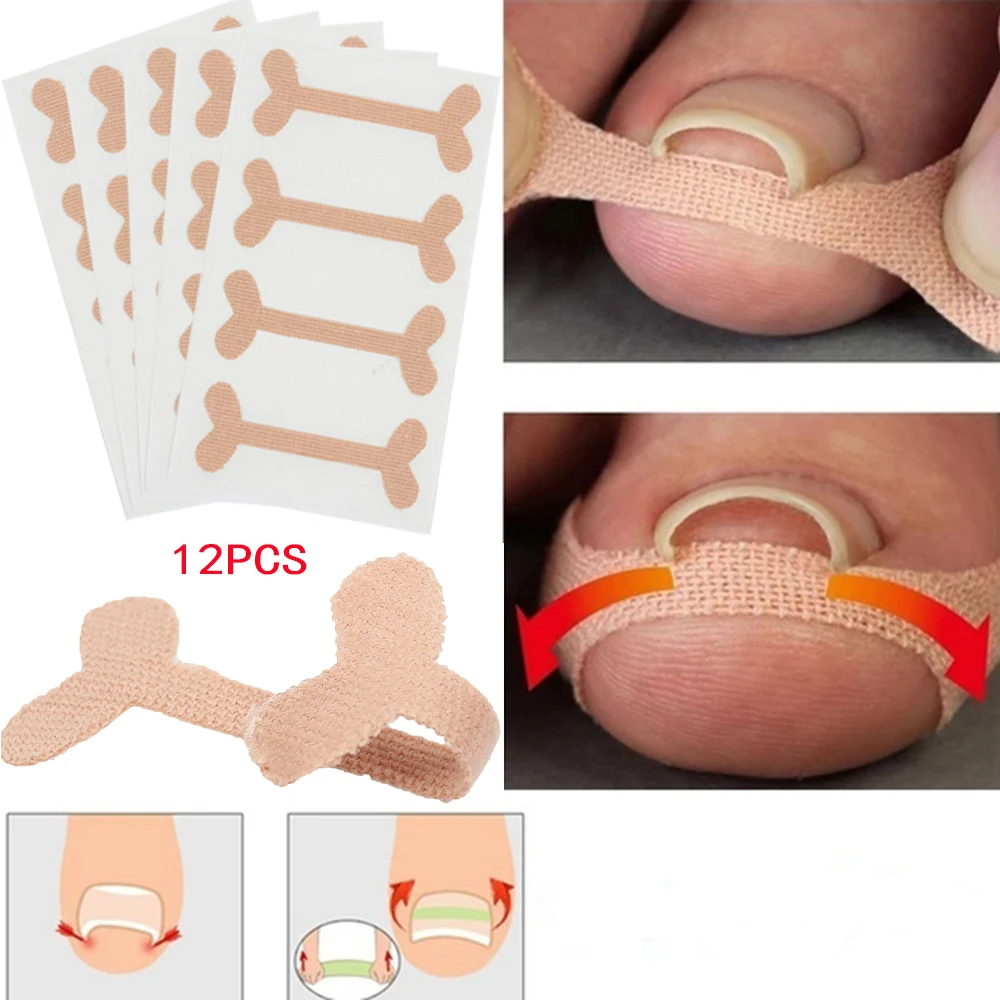 New Ingrown Toenails Band Aid Relief Pain Paronychia Correction Pedicure Elastic Force Sticker Repair Bandage Toe Nail Care