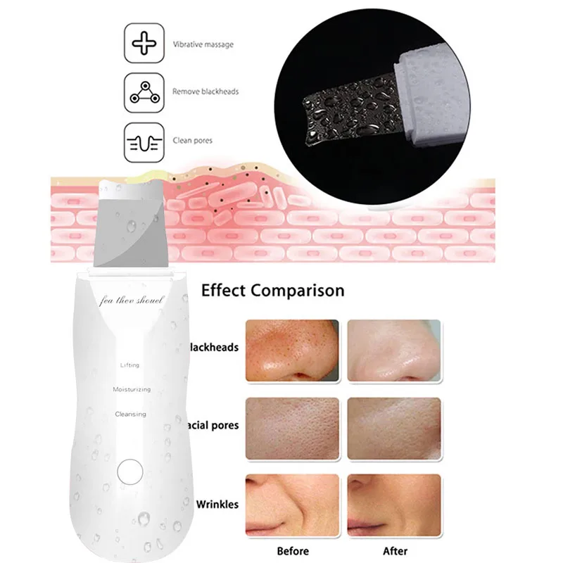 Goedkoop Abay Ultrasone Huid Scrubber Ion Diepe Gezicht Reinigingsmachine Peeling Schop Facial Pore Cleaner Trillingen Lift Machine Schoonheid