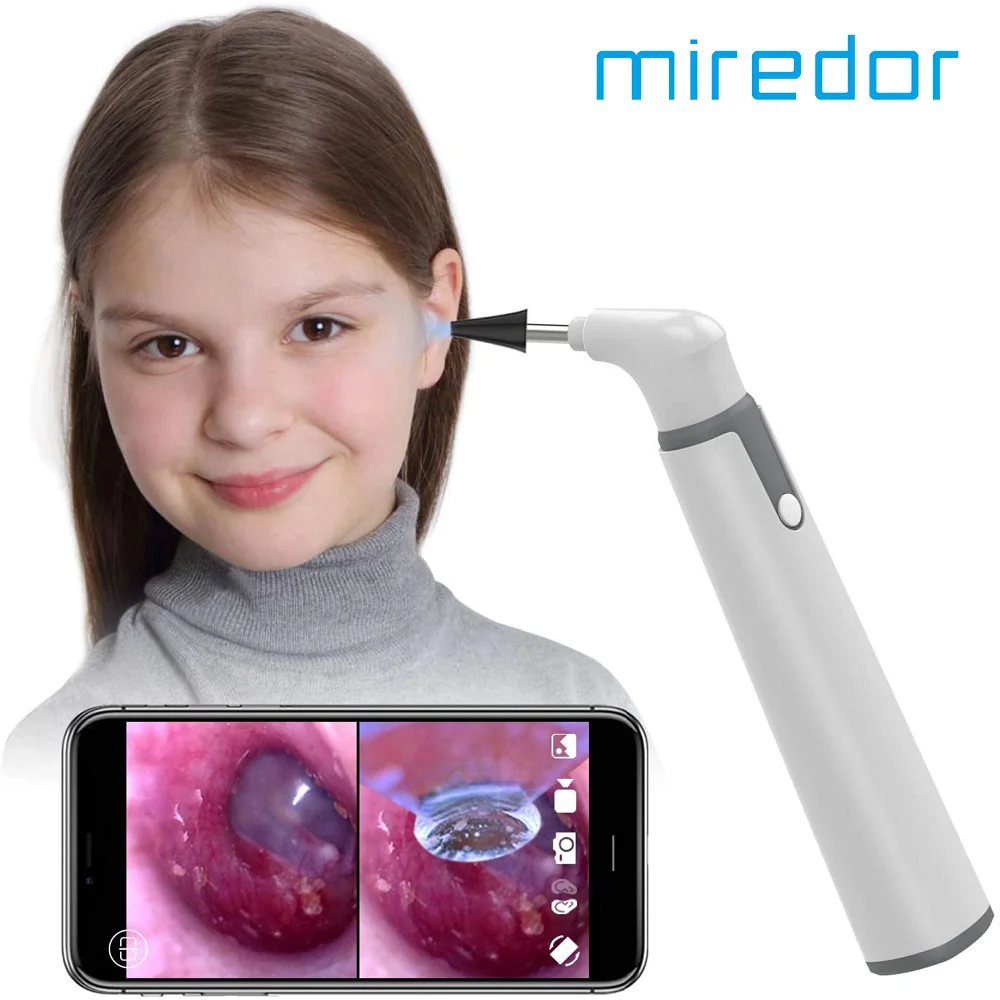 Miredor Wireless Otoscope Ear Camera with Dual View, 3.9mm 720PHD WiFi Ear Scope with 6 LED Lights for Kids and Adults, Compatib