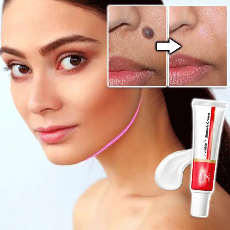 Whitening Freckle Cream Removal Melasma Acne Scar Pigment Melanin Sun Spots Face Care