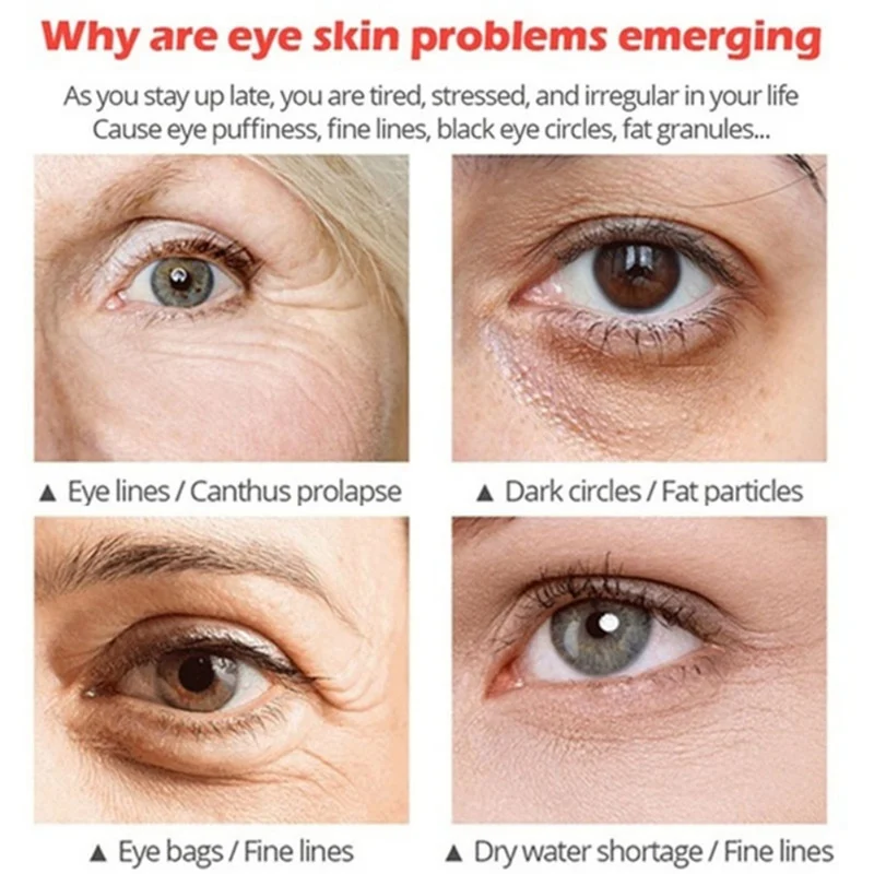 

Active Eye Cream Remove Eye Bags Dark Circles Anti-drying Anti-aging Eye Essence