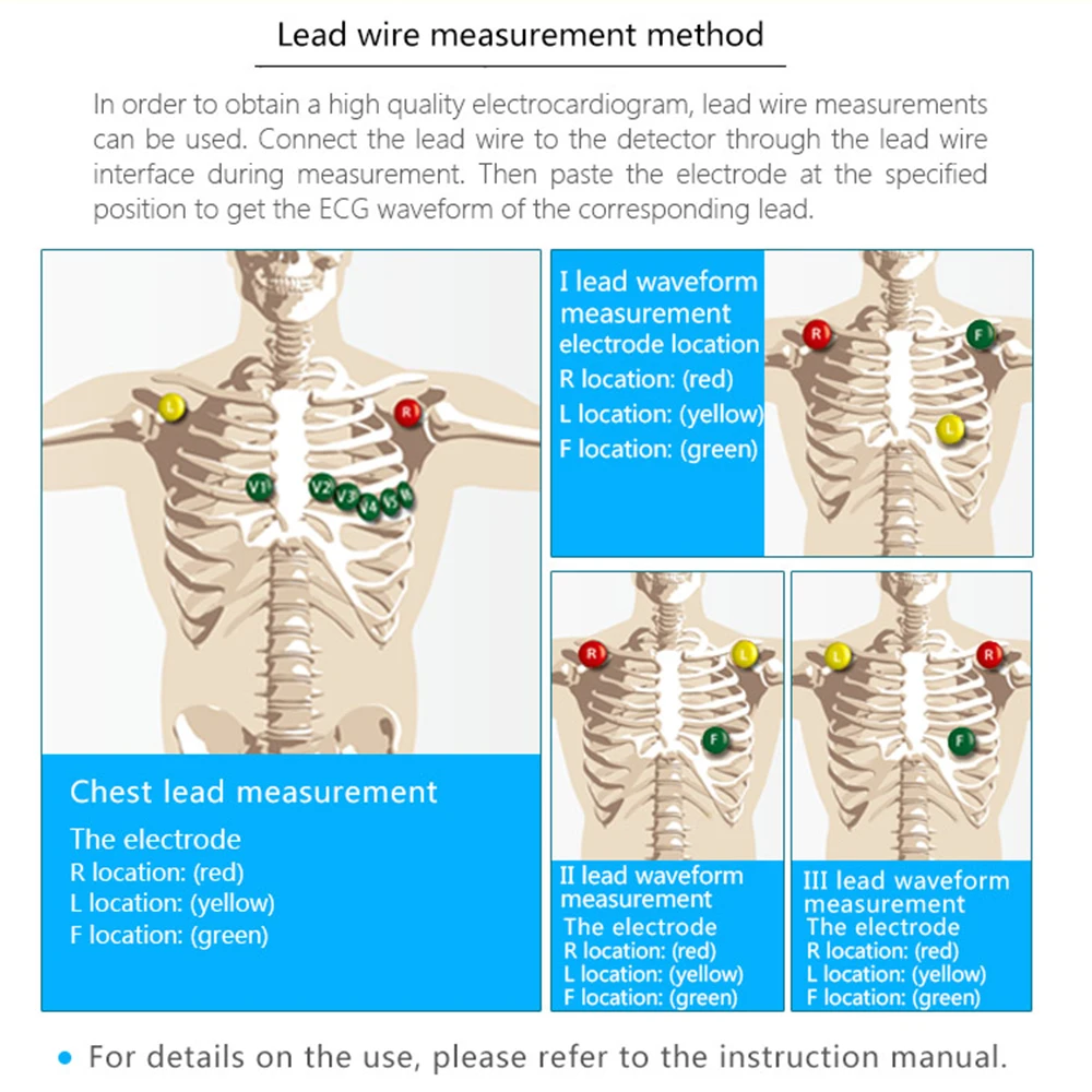 Бытовой электрокардиограмма устройство для контроля ЭКГ быстрое измерение в