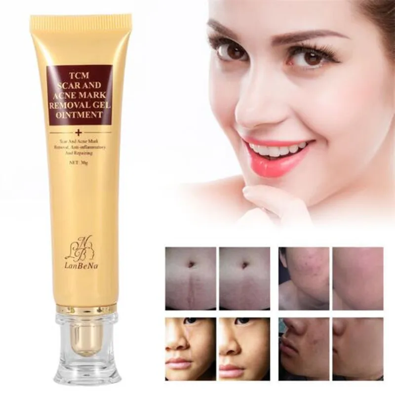 Крем для удаления акне LANBENA крем шрамов от пигментных пятен восстанавливает кожу