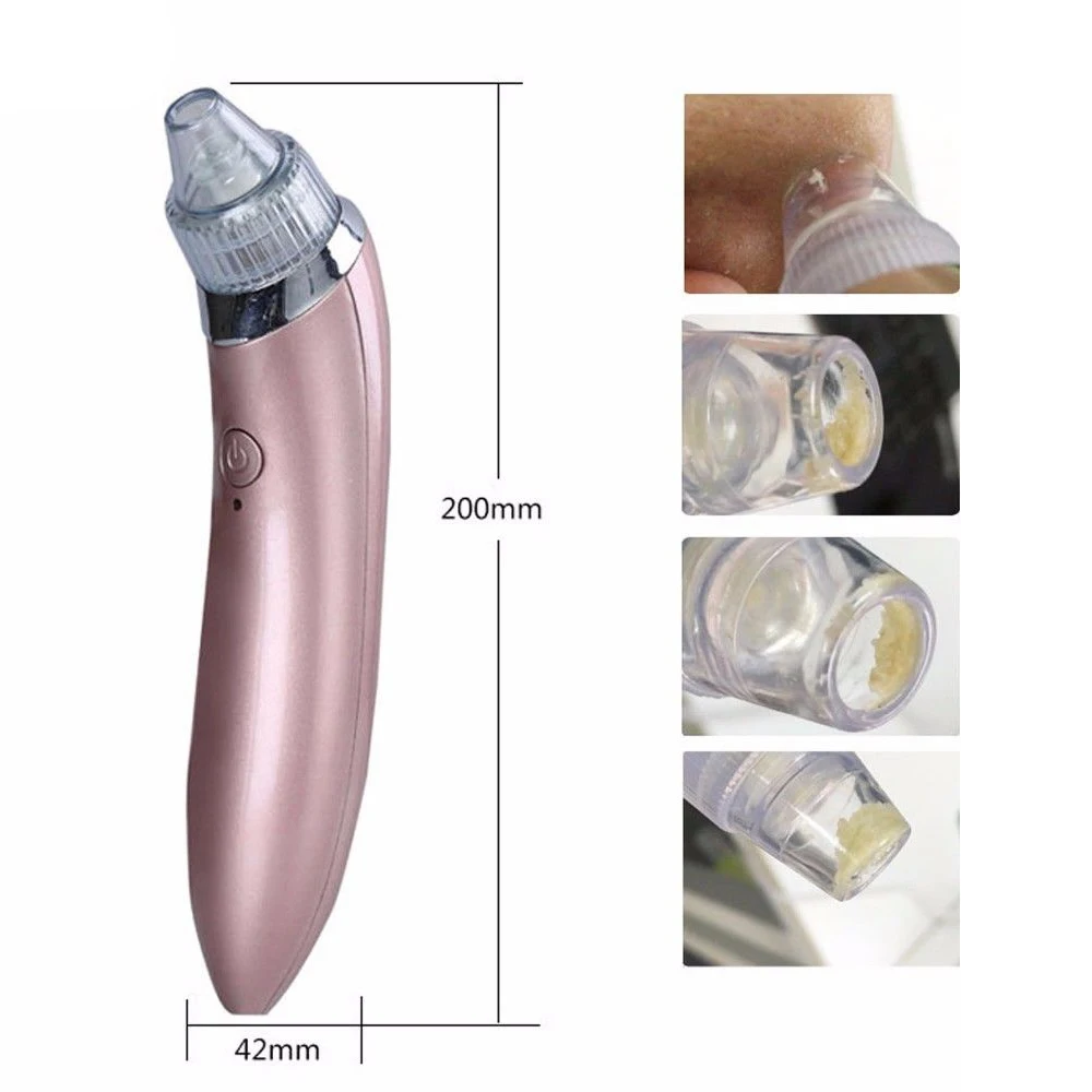 вакуумный очиститель пор multifunctional. вакуумный аппарат от черных точек gl-8060. Xn-8030; вакуумный очиститель для лица. вакуумный прибор для чистки кожи. вакуумный очиститель для кожи nx8030.